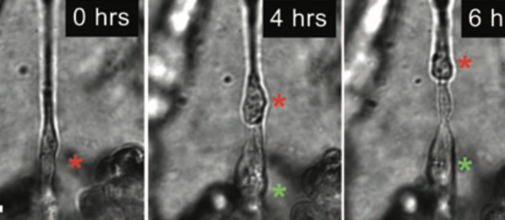 Time lapse de cellules cancéreuses le long d'un nerf.
