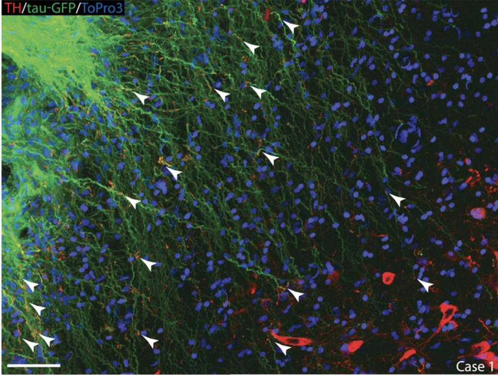 Maladie de Parkinson - Intégration des précurseurs neuraux dans les zones lésées du cerveau hôte (Wianny et al., Advanced Science 2022)
