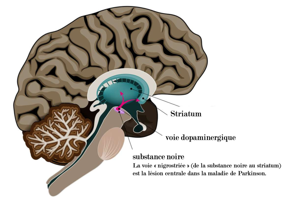 Zones du cerveau concernées par la maladie de Parkinson (DR)