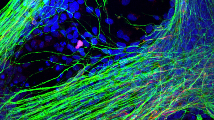 Génération de neurones à partir des cellules souches pluripotentes induites. © Inserm/Afsaneh Gaillard