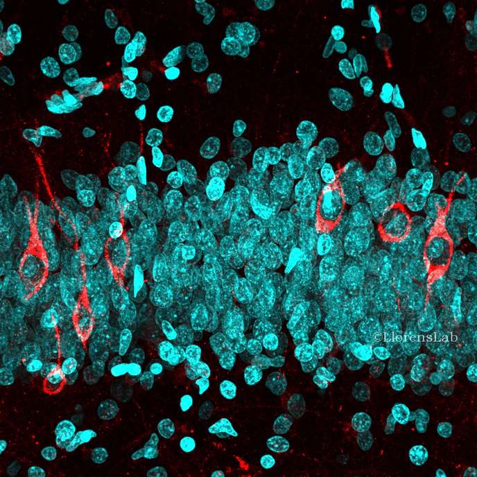 Neurogénèse adulte chez l'homme (©Llorens Lab)