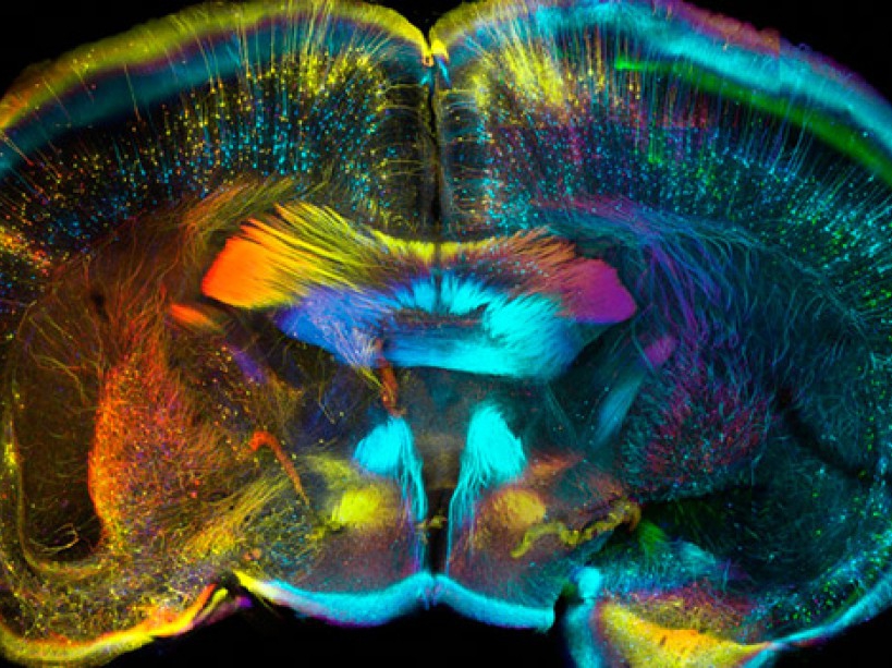 Cellules nerveuses d'une section de cerveau de souris adulte. LUIS DE LA TORRE-UBIETA